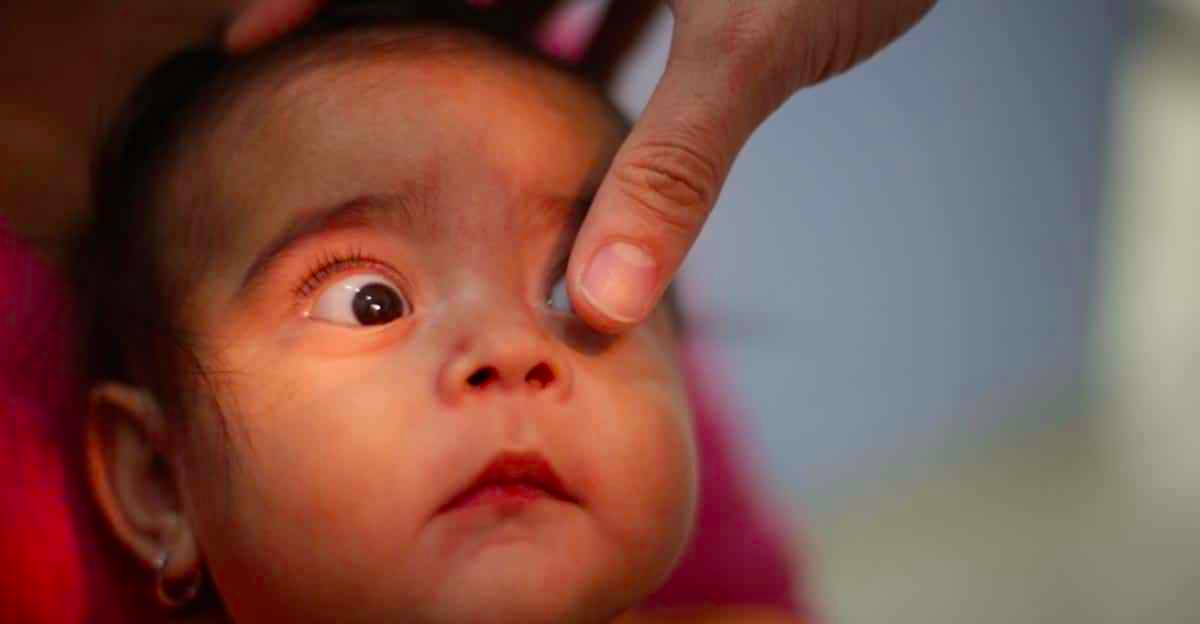 AI better than most human experts at detecting cause of preemie blindness