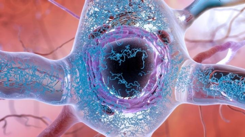 The ‘Big Bang’ of Alzheimer’s: Scientists ID genesis of disease