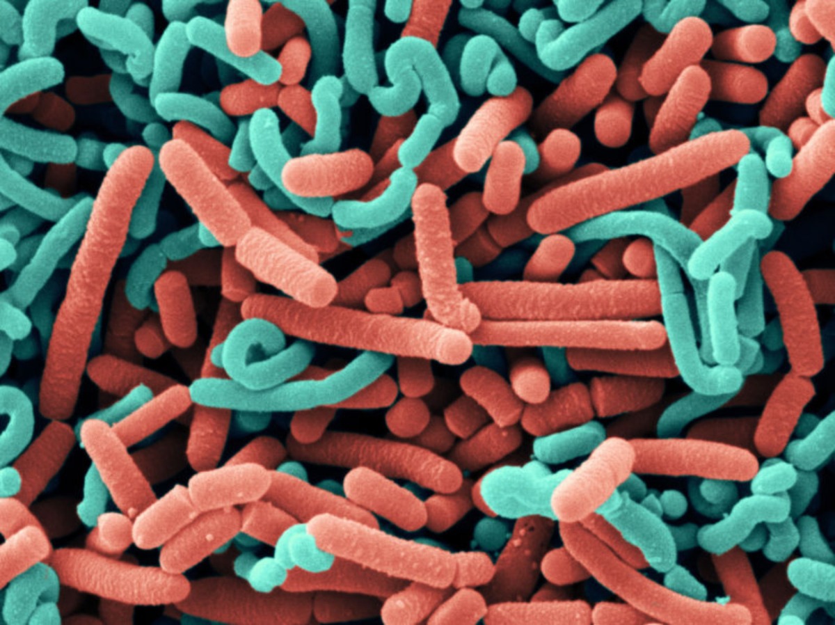 Probiotics: If you don’t just just poop them out, they may muck up your guts